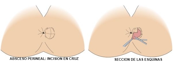revisión masaje anal revisión masaje anal